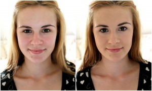 Makeup for Acne